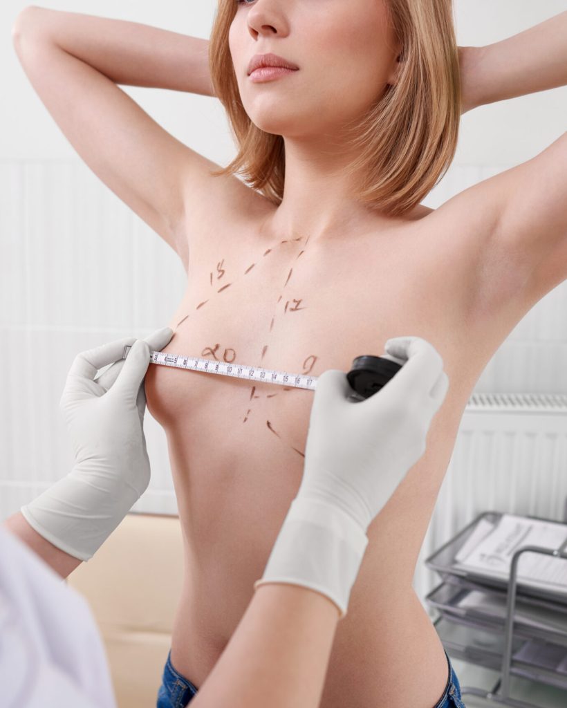 Cropped close up of a female plastic surgeon drawing line on breast of a woman preparing for augmentation surgery medicine beauty profession occupation.